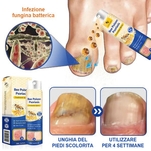 Spray per la psoriasi al veleno d'api
