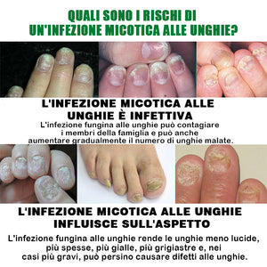 Soluzione per la cura delle unghie allo zenzero