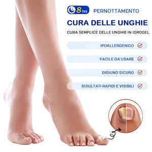 micosi alle unghie