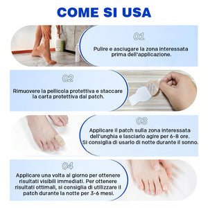 micosi alle unghie