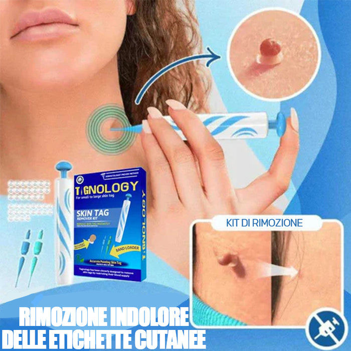 Strumento 2 in 1 per la rimozione delle verruche