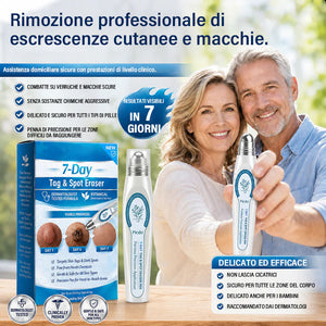 Prodotto roll-on avanzato per la rimozione di nei e verruche