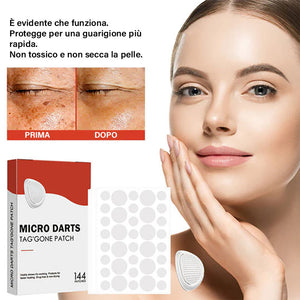 Cerotti idrocolloidali a microaghi per la rimozione di acne e verruche | - 🛒Acquista uno e ricevi uno gratis (2 scatole)🎁