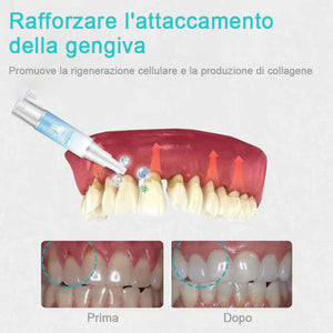 Gel per la riparazione dei denti (acquista 1 prendi 1 gratis)