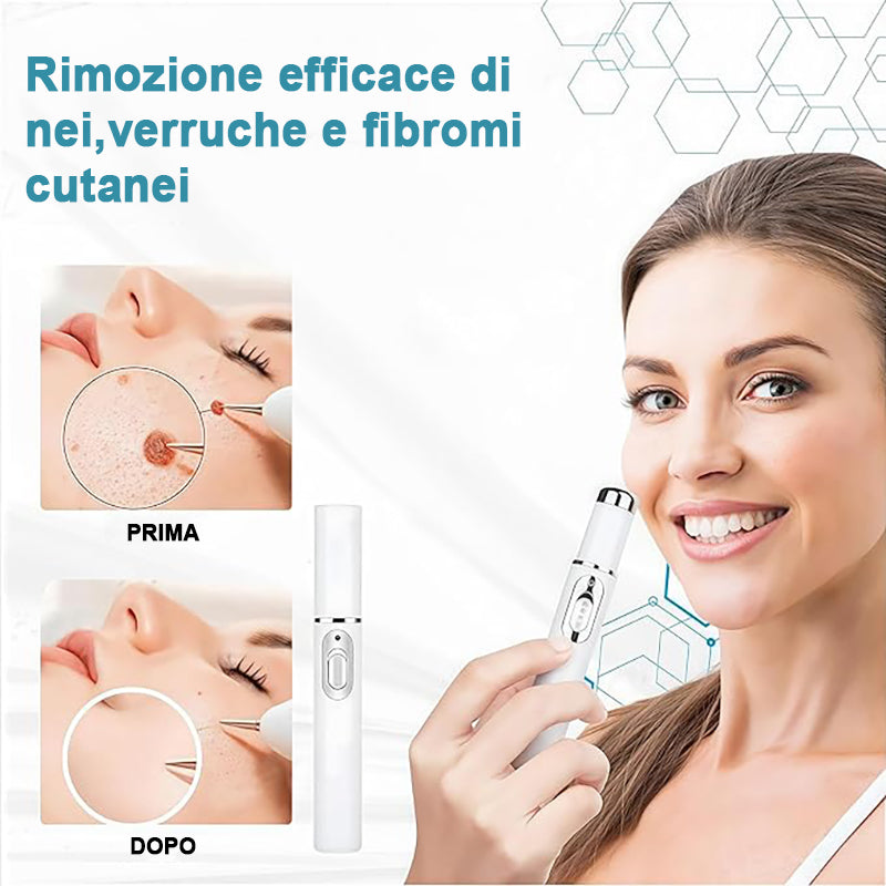 Penna Per La Rimozione Di Verruche E Nei Per La Cura Del Corpo - Foto 12