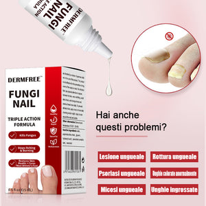 Soluzione a base di erbe per la cura delle unghie