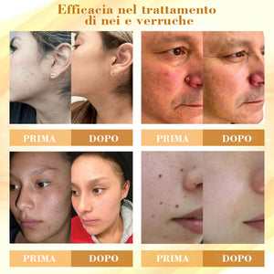 Crema riparatrice concentrata al veleno d'api