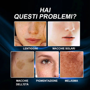 Crema sbiancante e anti-lentiggini alla vitamina C