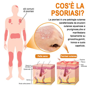 Spray per la psoriasi al veleno d'api