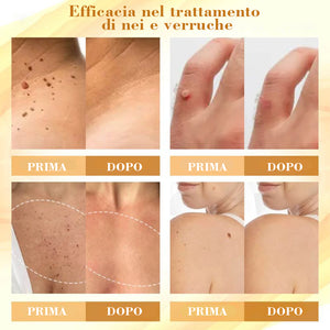 Crema riparatrice concentrata al veleno d'api