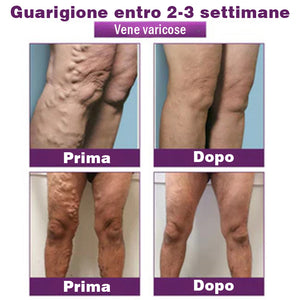 Cerotti per il corpo (per vene varicose, capillari e gonfiore alle gambe)