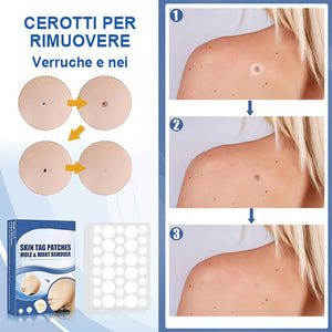 Cerotti per la rimozione di verruche e nei (acquista 1 e ricevine 1 gratis)