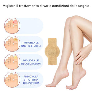 micosi alle unghie