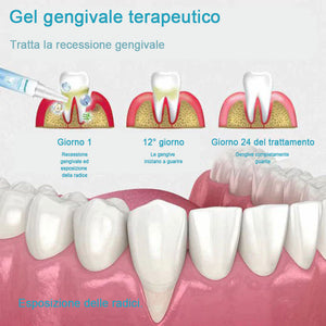 Gel per la riparazione dei denti (acquista 1 prendi 1 gratis)