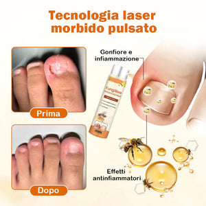 Spray riparatore avanzato per unghie