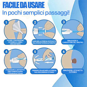 Strumento 2 in 1 per la rimozione delle verruche