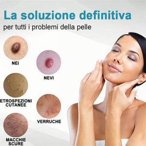Penna per la rimozione di verruche e nei per la cura del corpo