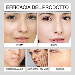Crema schiarente per lentiggini alla vitamina C - Acquista 1 e ricevine 1 in omaggio (2 pezzi)