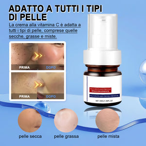 Crema sbiancante e anti-lentiggini alla vitamina C