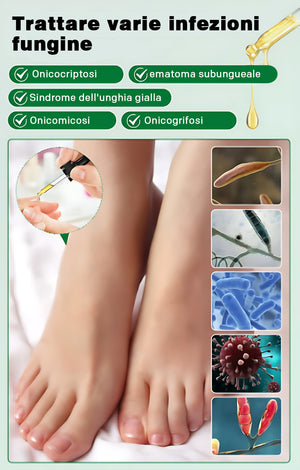 Soluzione per la cura delle unghie allo zenzero