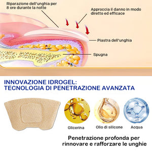 micosi alle unghie