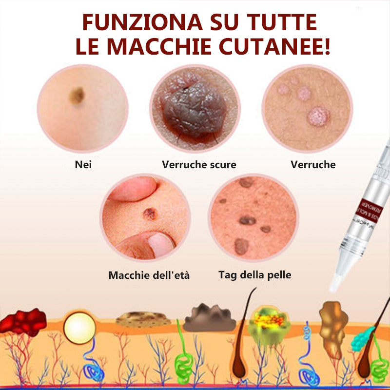 Come Insegnare Al Cane A Non Mordere: I Consigli Per Educarlo - Foto 8