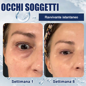 Crema idratante per gli occhi - 🎁Confezione da 2 (trattamento completo)🎁