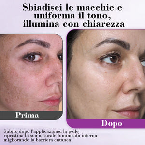 Essenza anti-iperpigmentazione avanzata