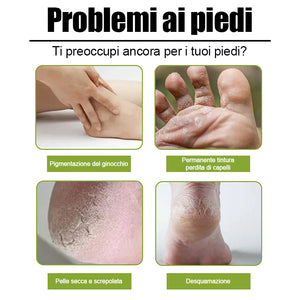 Spray esfoliante per i piedi migliora la pelle ruvida adatto a tutto il corpo