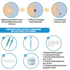 Strumento 2 in 1 per la rimozione delle verruche