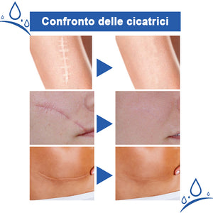 Crema riparatrice per cicatrici