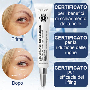 Crema idratante per gli occhi - 🎁Confezione da 2 (trattamento completo)🎁