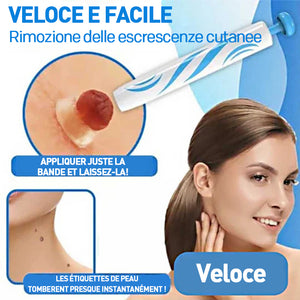 Strumento 2 in 1 per la rimozione delle verruche
