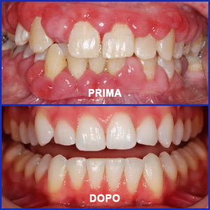Dentifricio al veleno d'api