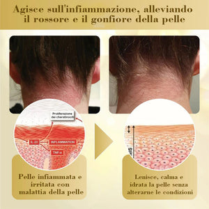 Crema riparatrice concentrata al veleno d'api