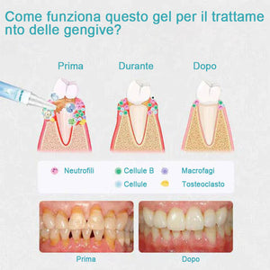 Gel per la riparazione dei denti (acquista 1 prendi 1 gratis)