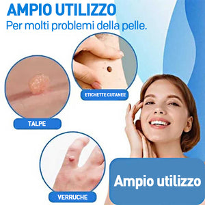 Strumento 2 in 1 per la rimozione delle verruche
