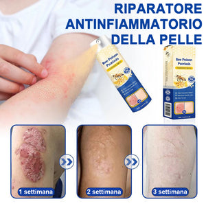 Spray per la psoriasi al veleno d'api