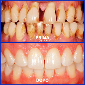 Dentifricio al veleno d'api