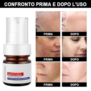 Crema sbiancante e anti-lentiggini alla vitamina C