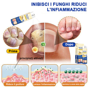 Spray per la psoriasi al veleno d'api