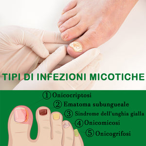 Soluzione per la cura delle unghie allo zenzero