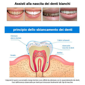 PENNE SBIANCANTI DEI DENTI